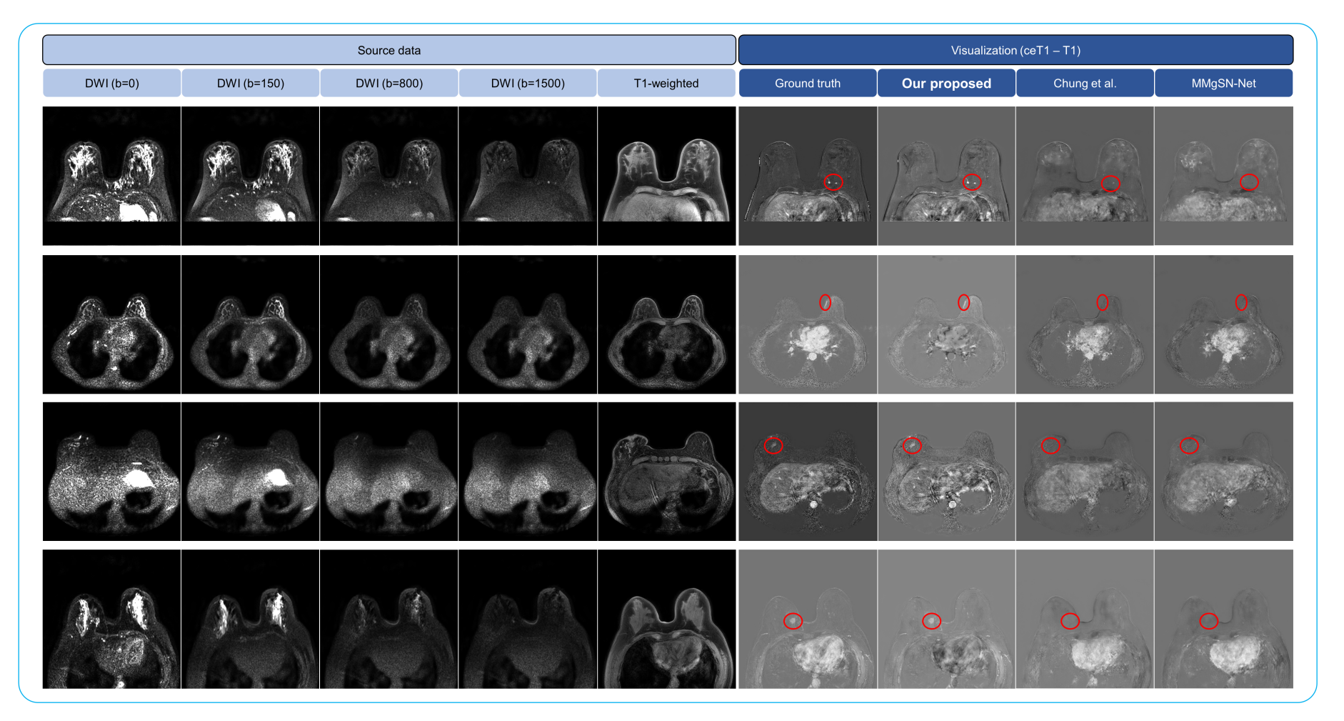 Synthetic-MRI-results.jpeg